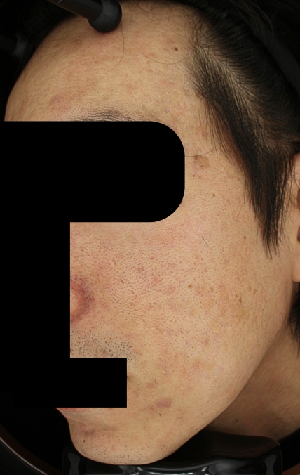 치료후기 이미지