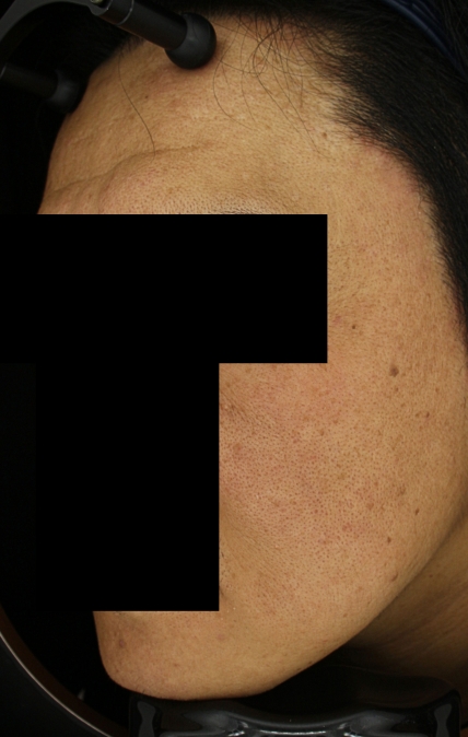 치료후기 이미지