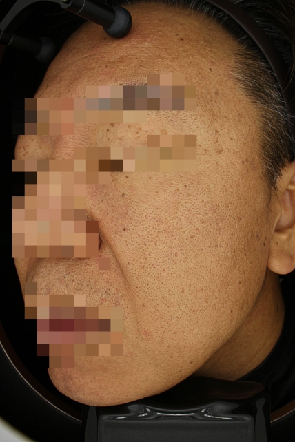 치료후기 이미지