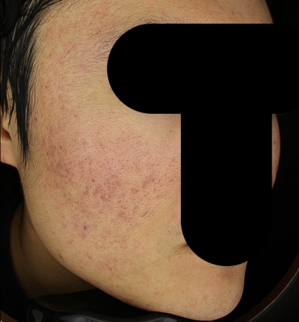치료후기 이미지