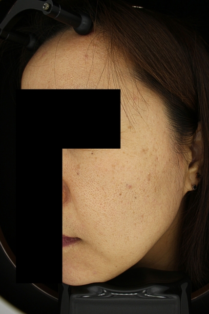 치료후기 이미지