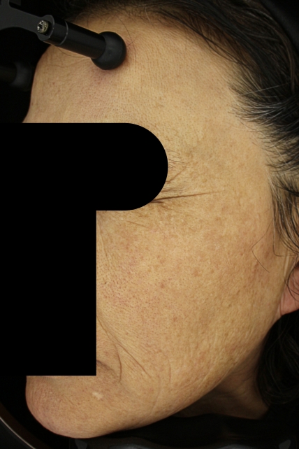 치료후기 이미지