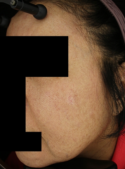 치료후기 이미지