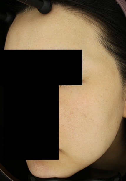 치료후기 이미지