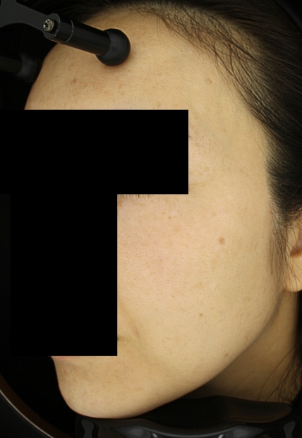 치료후기 이미지