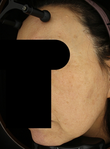 치료후기 이미지