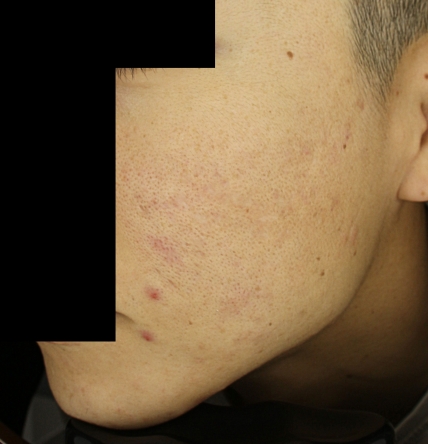 치료후기 이미지