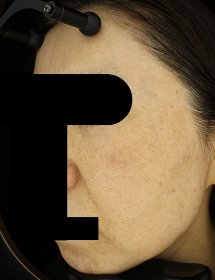 치료후기 이미지