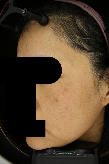 치료후기 이미지