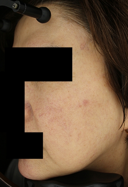 치료후기 이미지