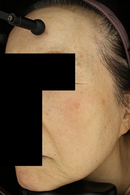 치료후기 이미지