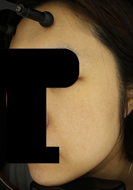 치료후기 이미지