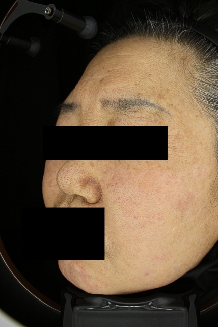 치료후기 이미지