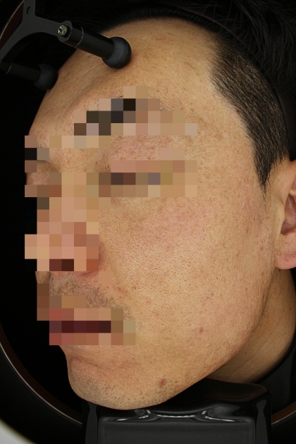 치료후기 이미지