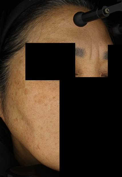 치료후기 이미지