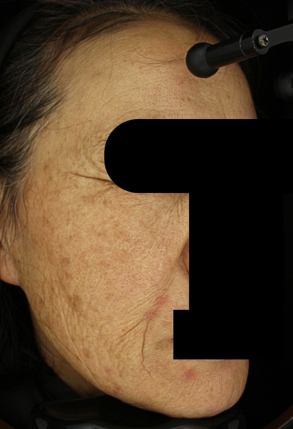 치료후기 이미지