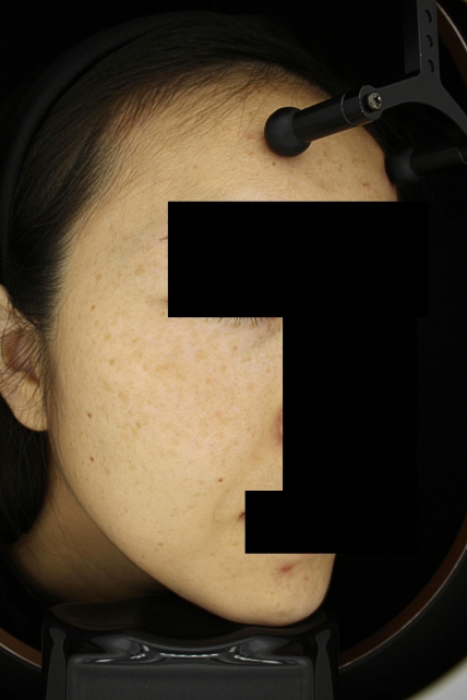 치료후기 이미지