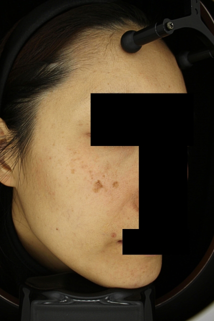 치료후기 이미지