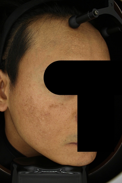 치료후기 이미지