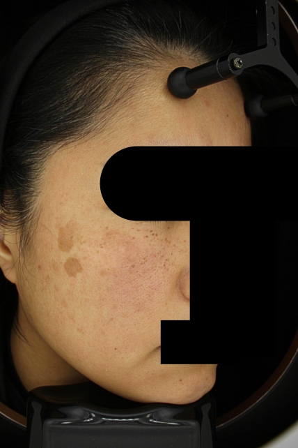 치료후기 이미지