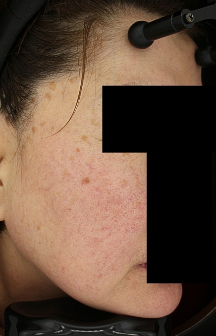 치료후기 이미지