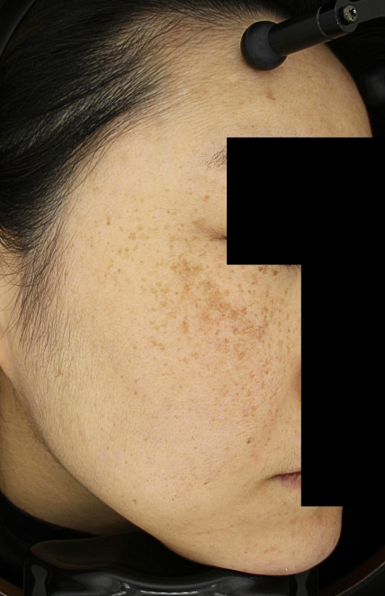 치료후기 이미지