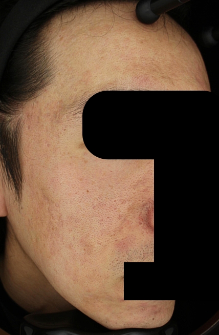 치료후기 이미지