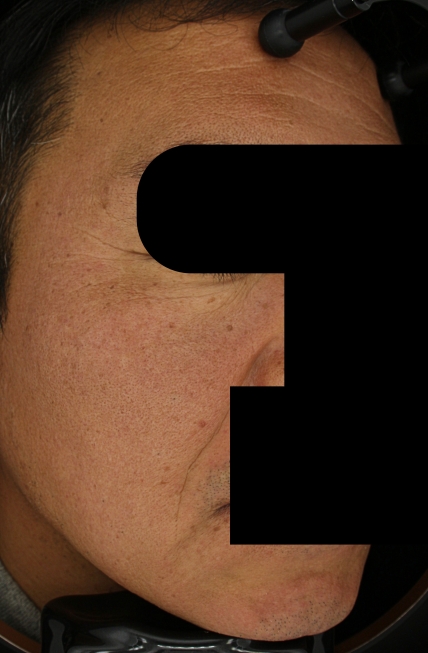 치료후기 이미지