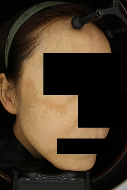 치료후기 이미지