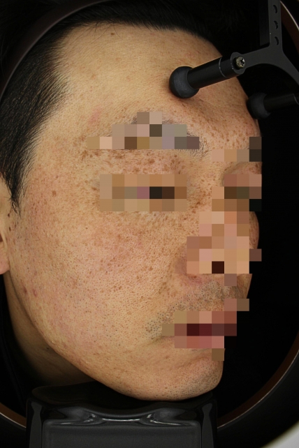 치료후기 이미지