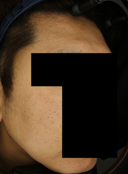 치료후기 이미지