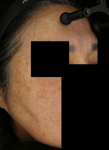 치료후기 이미지