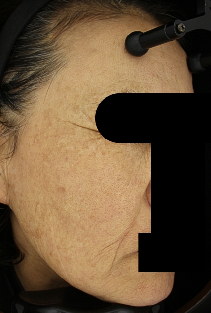 치료후기 이미지