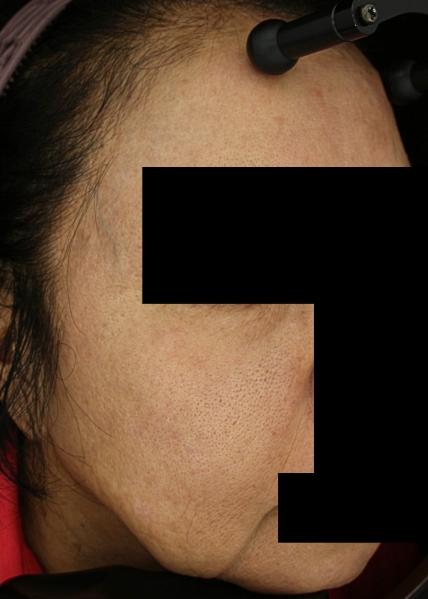 치료후기 이미지