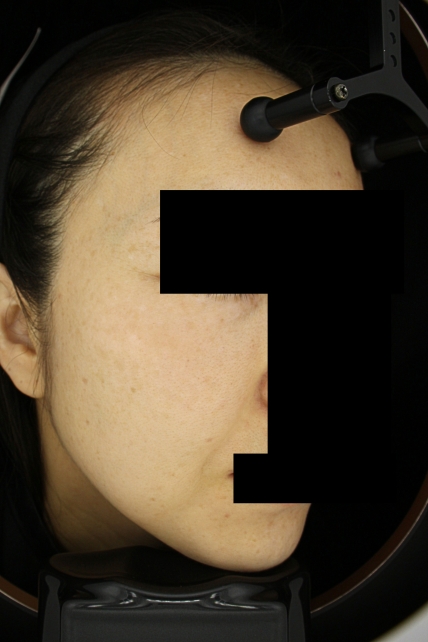 치료후기 이미지