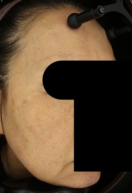 치료후기 이미지