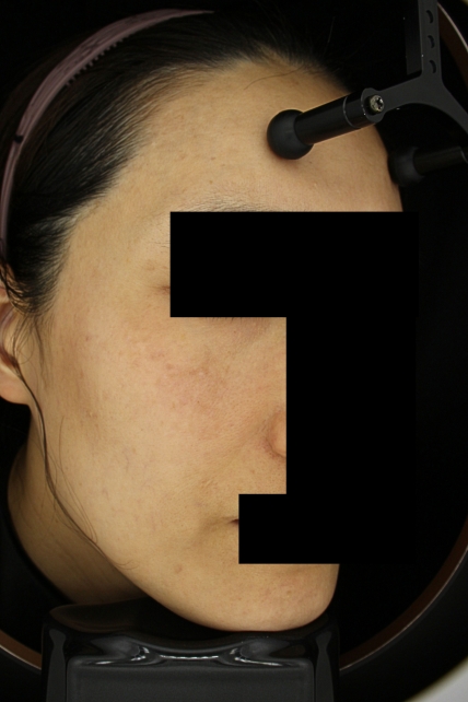 치료후기 이미지