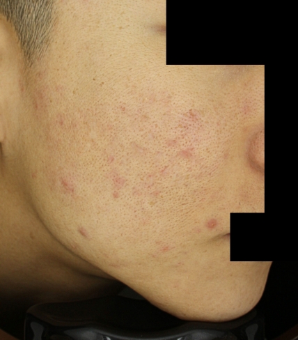 치료후기 이미지