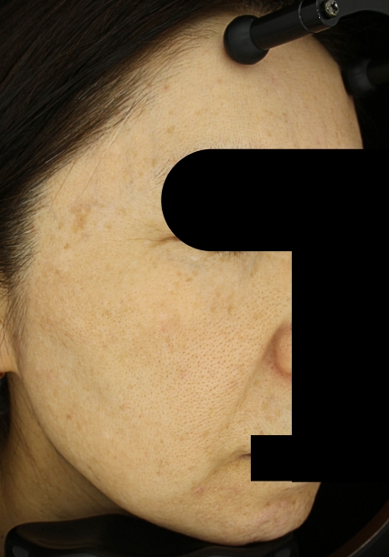 치료후기 이미지