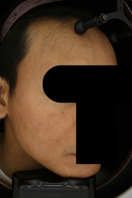 치료후기 이미지