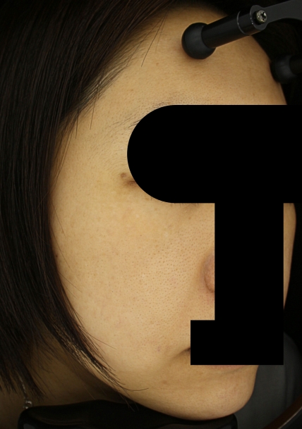 치료후기 이미지