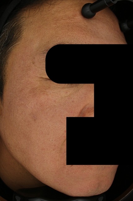 치료후기 이미지