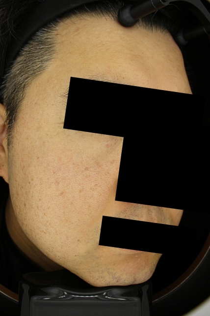 치료후기 이미지