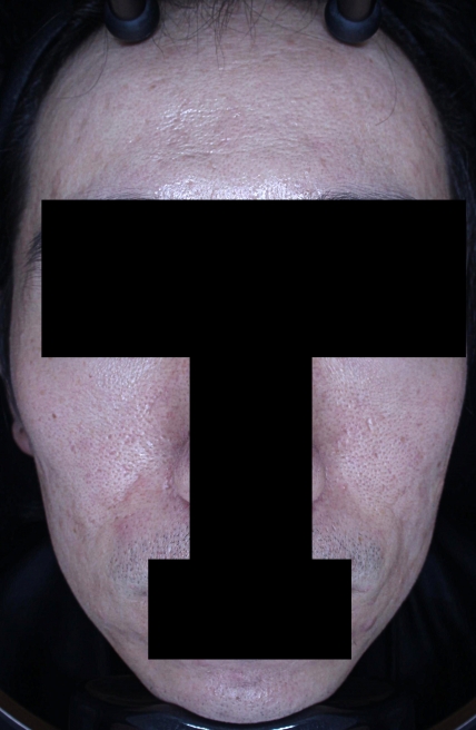 치료후기 이미지