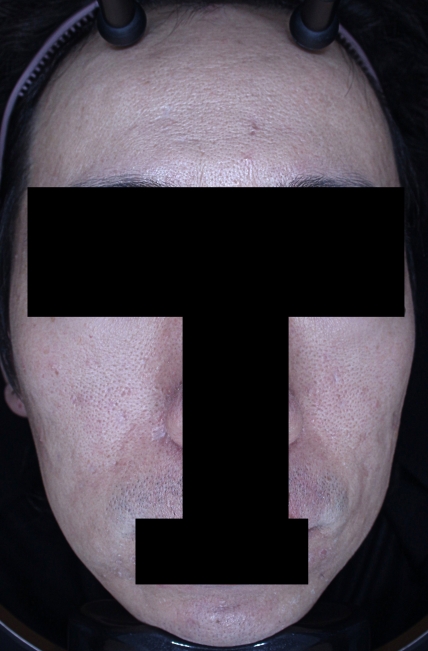 치료후기 이미지