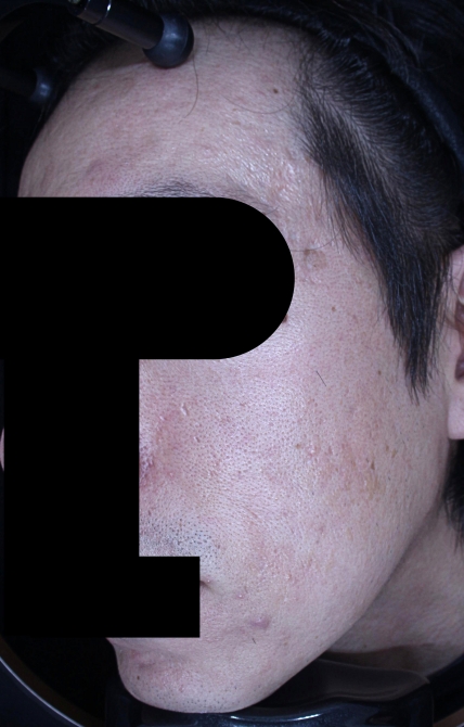 치료후기 이미지