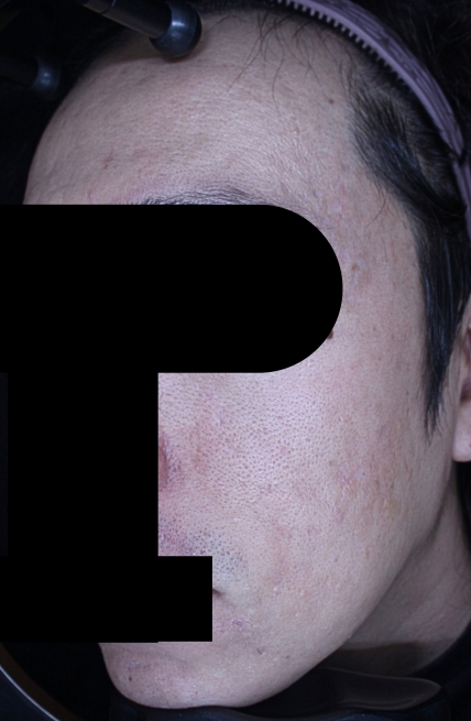 치료후기 이미지