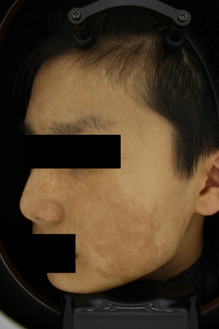 치료후기 이미지
