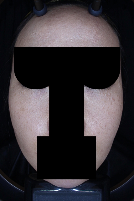 치료후기 이미지